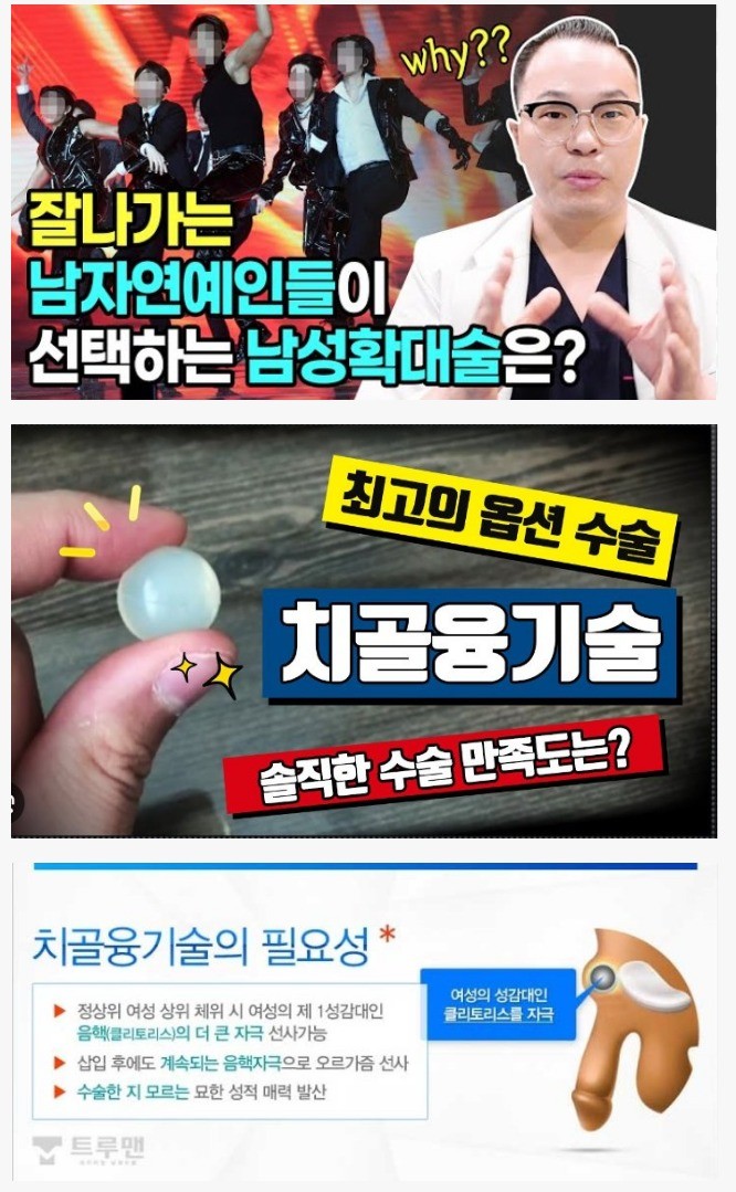 잘나가는 남자아이돌이 많이 하는 확대 수술