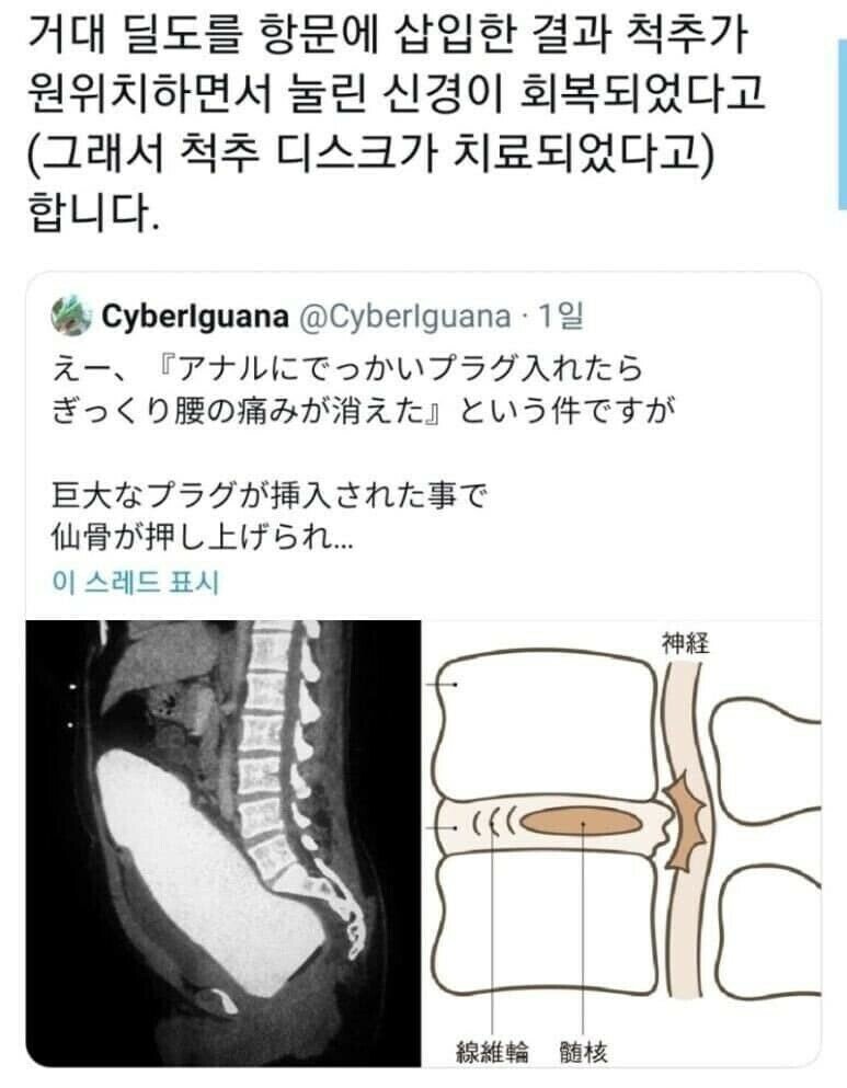 의외로 많이들 모르는 딜도의 효능