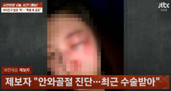 현역 태권도 선수가… 길거리서 발로 여성 얼굴 무차별 폭행