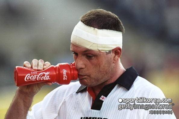 '알코올 중독, 혼수 상태'...