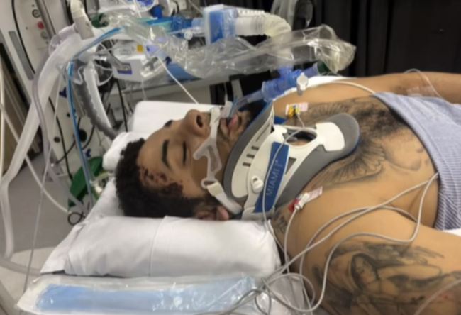 이렇게 억울하고 잔인한 인생 또 있을까? 음주운전 차에 치여 다리 잃은 축구선수