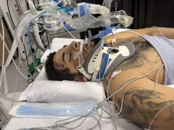 英 BBC 충격, 음주운전 女 차량에 치인 축구선수 ‘다리 절단’→EPL 유망주 이른 나이 은퇴