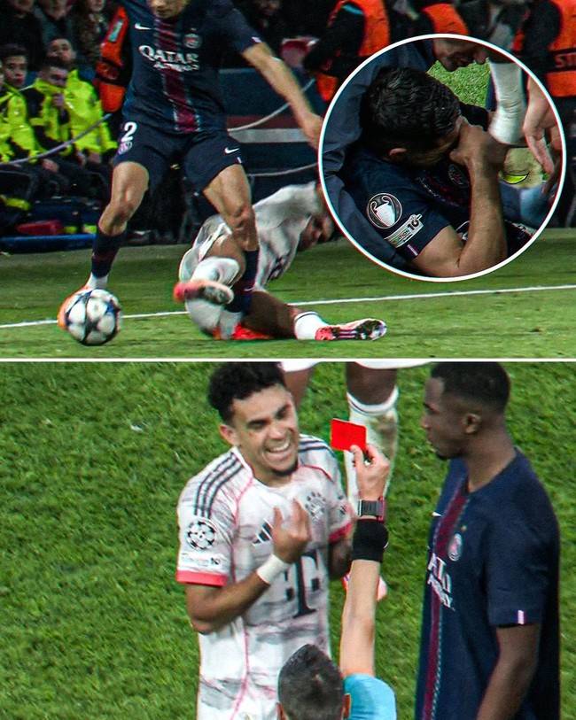 살인태클로 상대 발목 작살내놓고 퇴장 받으니 웃은 디아스...하키미는 3~5주 결장 예상