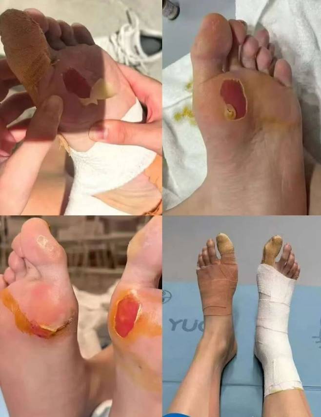 안세영과 죽도록 싸우더니…'천적' 中 천위페이 휠체어 신세 '충격'→중국도 깜짝 놀랐다