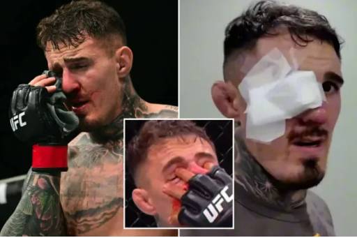 '은퇴 시사' 눈 찔려 실명위기 UFC 챔피언, 깜짝 폭탄발언