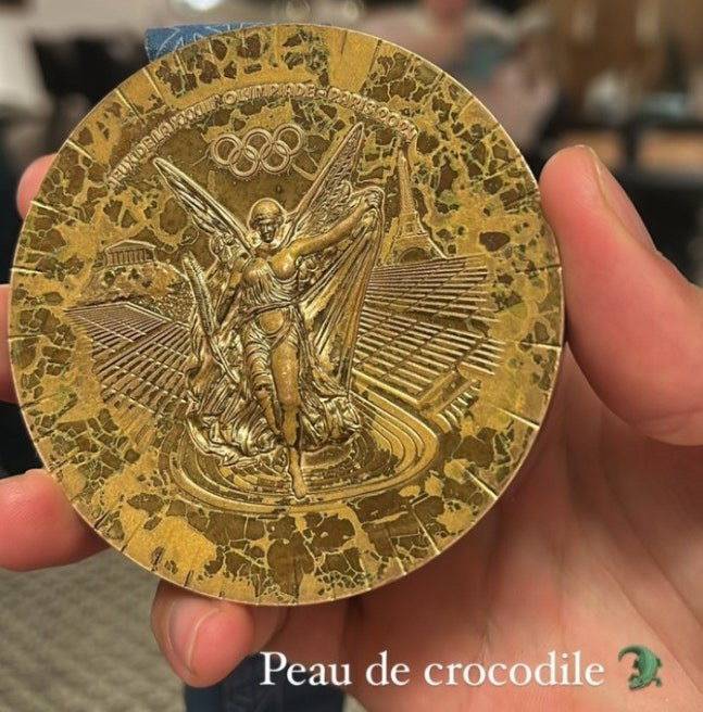 메달이 이 지경…받자마자 빛 바래고, 한 번 걸면 리본 ‘뚝’, 기쁨도 잠깐 ‘울화통’