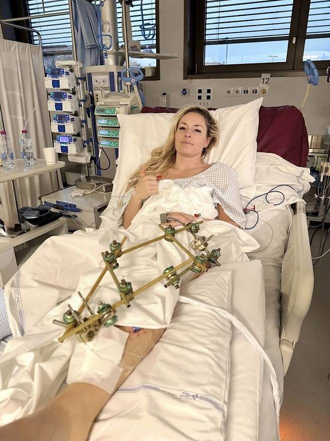 13초 만의 비극…'스키 여제' 린지 본 '다리 절단' 기로