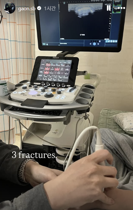 '금메달' 최가온, 골절상 진단 나왔다…SNS에 진단 결과 암시→'투혼의 올림픽 챔피언' 더더욱 감동 [2026 밀라노]