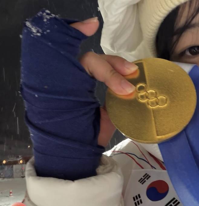 도저히 믿기지 않는 韓 금메달, 세 군데 골절 진단…손가락 뼈 부상에도 ‘부상 투혼’ 최가온