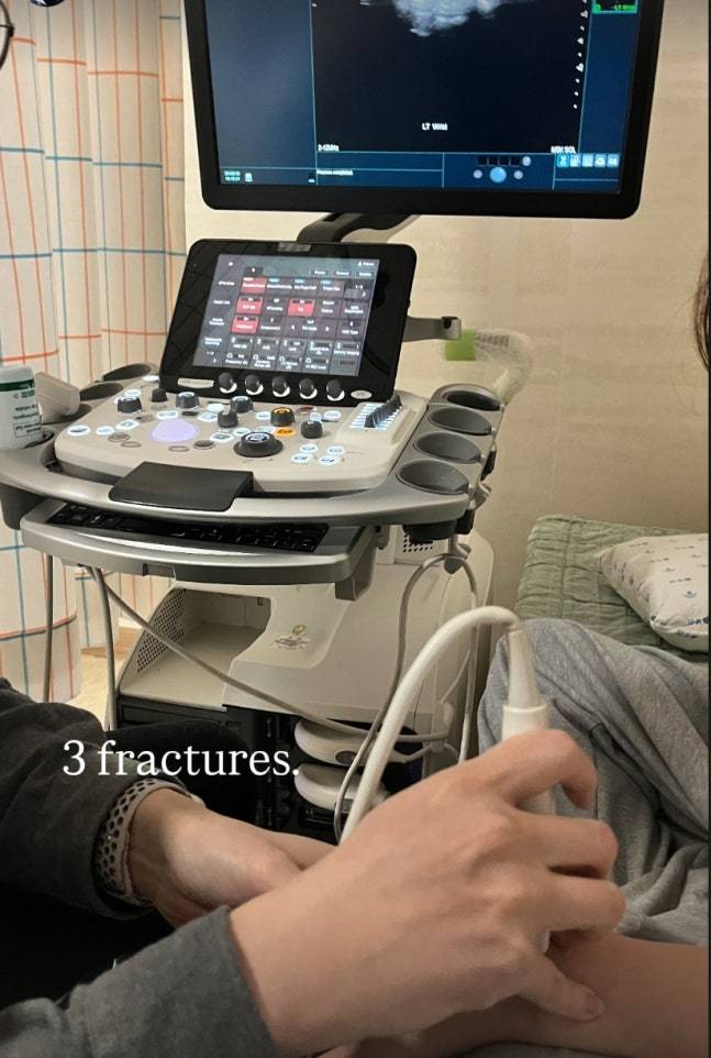 도저히 믿기지 않는 韓 금메달, 세 군데 골절 진단…손가락 뼈 부상에도 ‘부상 투혼’ 최가온