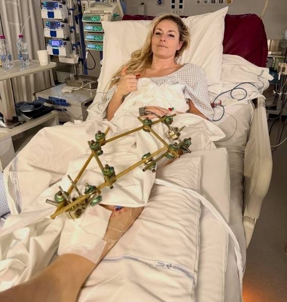 '십자인대 파열→올림픽 출전 강행? 이기적이다' 비난 쇄도, 다리 절단 수술 위기 레전드 고백