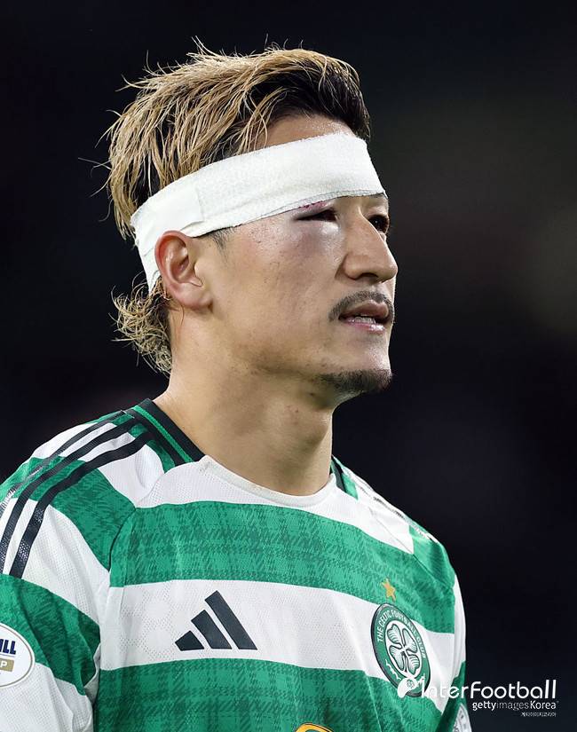 일본 열도도 부끄럽다...양현준과 같이 셀틱 선발 뛸 자격 없다, 일본인 듀오 향한 비난 거세다