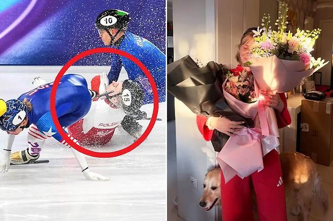 '스케이트 날에 안면 베인' 쇼트트랙 스타, 수술 후 얼굴 '절반' 가린 안타까운 근황