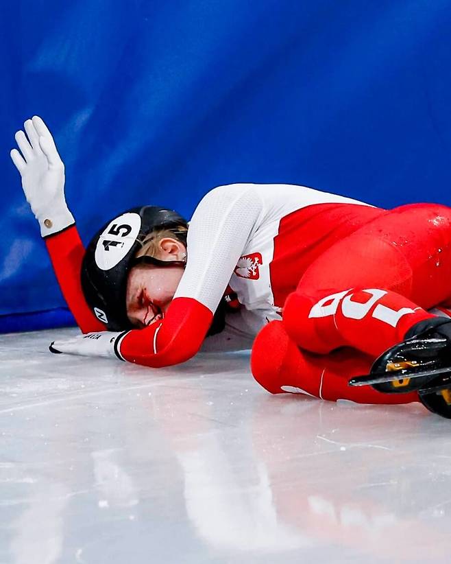 '피 철철' 스케이트 날이 얼굴로...女 쇼트트랙 선수, 수술 후 폴란드 복귀 근황 공개
