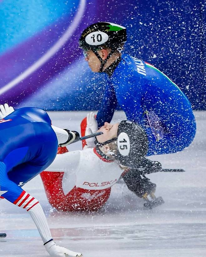'피 철철' 스케이트 날이 얼굴로...女 쇼트트랙 선수, 수술 후 폴란드 복귀 근황 공개