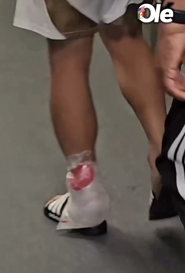 ‘퇴장에도 손흥민에 끝까지 항의’ LAFC 감독 결국 한마디 했다…“잘 알던 선수지만, 쏘니 발을 봐라”