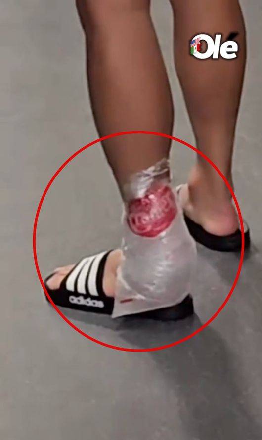 이래놓고 항의를 해? 손흥민, 아킬레스건 직격→얼음 대고 절뚝절뚝...