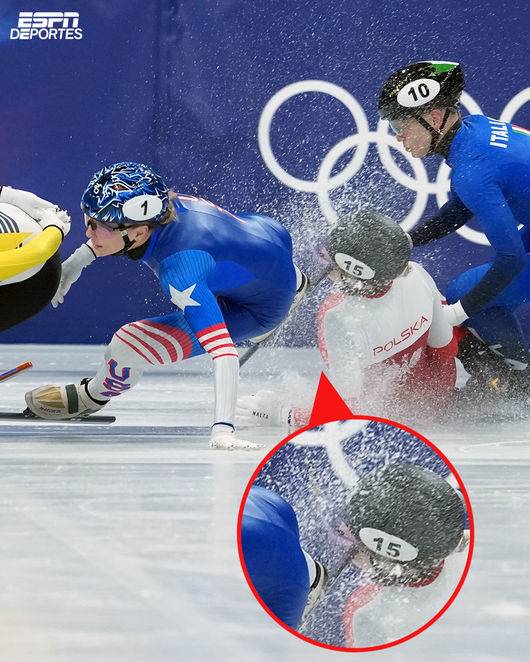 '스케이트 날에 안면 충돌' 피 철철 흘린 女 선수, 손흥민 받았던 그 수술 받았다...'얼굴 절반' 가린 근황 공개