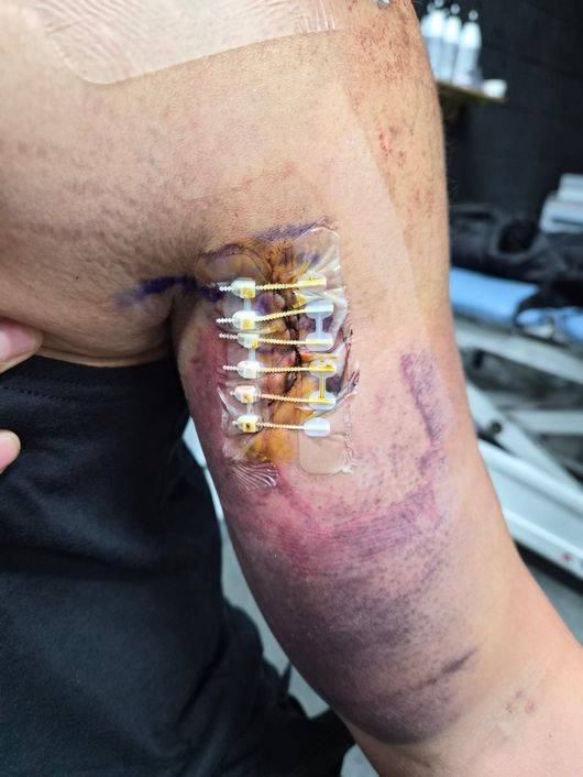 선배들의 WBC 응원, 추신수가 빠졌다. 노경은이 전한 안타까운 소식, “신수 형 어깨 인대 다 끊어져 수술…아무도 몰라줘” [단독]