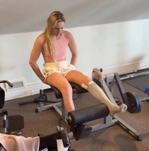 '다리 절단 위기' 린지 본, '은퇴하라' 팬들과 살벌 설전