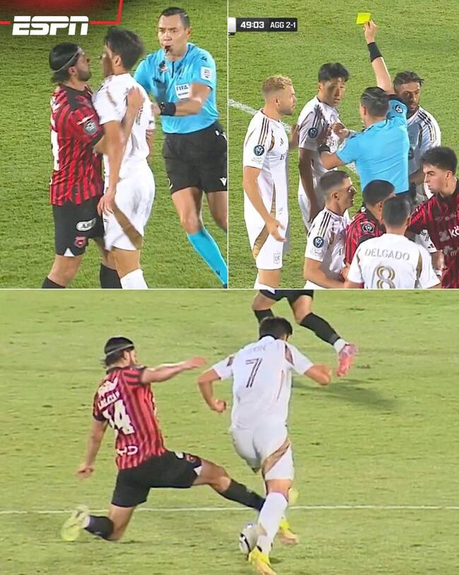 손흥민 어디까지 착할 건가…‘시즌 OUT+월드컵 낙마’ 아찔 부상 면했는데도 '살인 태클' 상대 용서