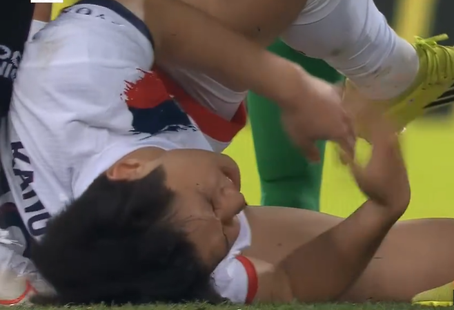 이강인 외마디 비명, PSG 감독 깜짝 놀랐다…아킬레스건 찍혀 대폭발→발목 다쳐 왼발 붕대+절뚝