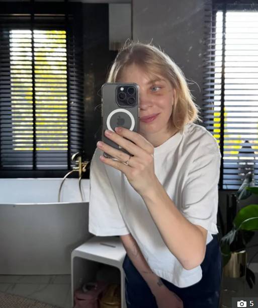 스케이트 날에 실명 위기