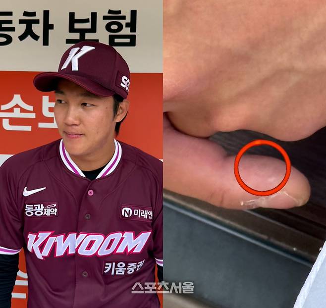 안우진 손 왜 이래? 알고 보니…오른 중지 ‘굳은살’이 나타낸 에이스의 ‘굳은 의지’ [SS시선집중]