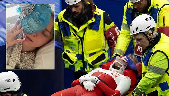 쇼트트랙 피 흘리며 쓰러졌다…얼굴 베인 사고, 영원히 남을 흉터에도