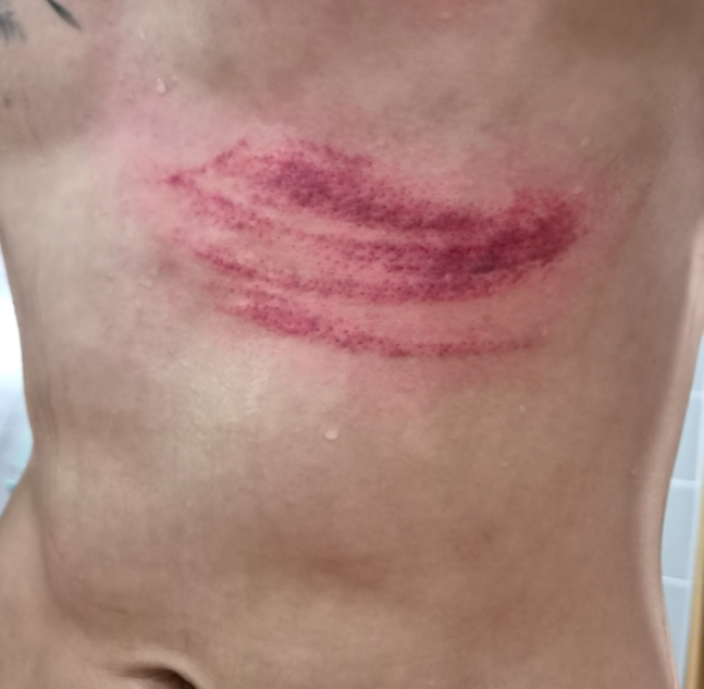 “갈비뼈 골절 아니었다” 쓰러진 최준, 예상 밖 결과…그러나 안심 못 한다