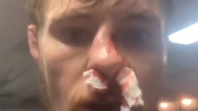 도와주세요, 보험이 없어요 팬들에게 도움 요청…UFC 파이터의 안타까운 현실