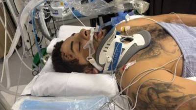 '음주·위험 운전 참변' 한 때 촉망받던 유망주, '다리 절단'...가해 여성, 결국 재판 넘겨졌다