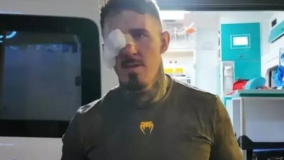 분노 폭발! 충격의 은퇴 시사, 앞이 보이지 않아 양쪽 눈 이상 호소한 아스피날...상대 조롱성 게시글에 비판 잇따라