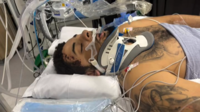 ‘음주운전 차량에 치여 다리 절단’…’30세’ 나이에 축구 선수 커리어 마감→가해자는 고작 징역 ‘28개월’