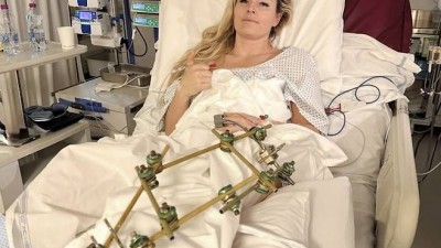 13초 만의 비극…'스키 여제' 린지 본 '다리 절단' 기로