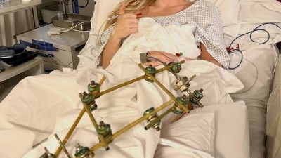 13초 추락→다리 절단 우려→4회 수술→퇴원 마침내 막 내린 린지 본, '파란만장' 올림픽…미국 귀국, 추가 수술 계획