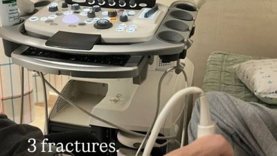 스노보드 '금메달' 최가온, 안타까운 근황 전해…세 군데 골절