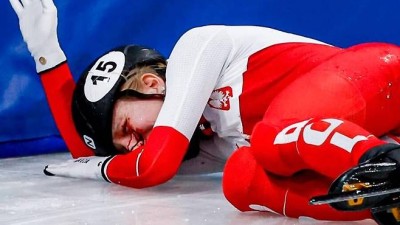 '피 철철' 스케이트 날이 얼굴로...女 쇼트트랙 선수, 수술 후 폴란드 복귀 근황 공개