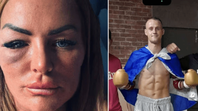 '격투기 선수, 무차별 폭행→두 아이 엄마, 삶 무너져'...뇌 손상·발작 후유증·12년 사업 폐업까지, 내게 모든 걸 뺏어갔다