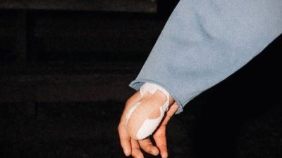 손가락 절반 찢어졌다 엄지에 붕대 칭칭...긴급 수술 후 근황 공개→A매치 출전 가능성 특별 훈련 소화한다