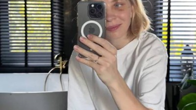 스케이트 날에 실명 위기 눈 밑에 티타늄 박았다 고백... 女 쇼트트랙 스타 '가려왔던 흉터' 생방송서 공개