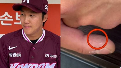 안우진 손 왜 이래? 알고 보니…오른 중지 ‘굳은살’이 나타낸 에이스의 ‘굳은 의지’ [SS시선집중]