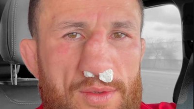 숨도 못 쉰다 훈련 중 코뼈 '산산조각'→끔찍 부상에도 수술 없이 경기 강행…메랍 은퇴 후 하겠다