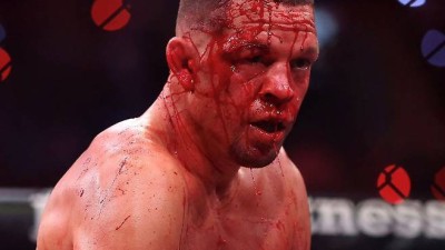UFC 레전드 맞아? 네이트 디아즈, 일방적으로 얻어맞고 '피 철철'…손가락·코뼈 골절+20바늘 봉합→처참했던 복귀전